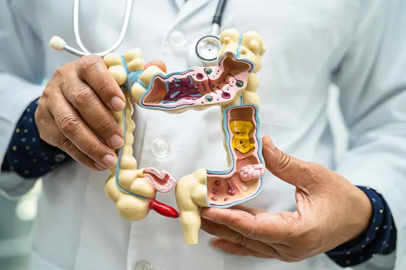 Microbiota intestinal (Foto: Envato)