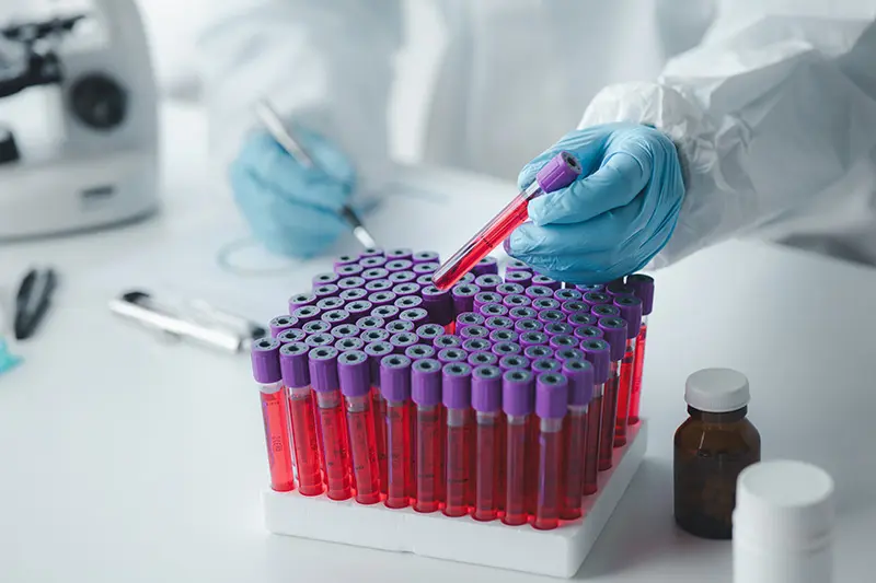 Muestras de sangre (Foto: Medicina Cantabria)