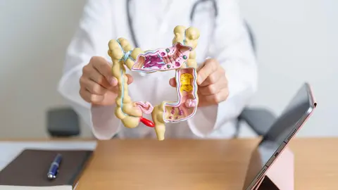 Un médico muestra un modelo de anatomía del colon humano