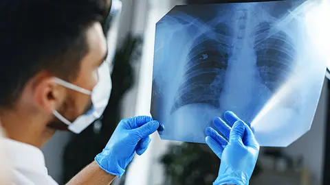 Un médico observa los pulmones (Foto: envato)