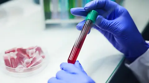 Tubo de análisis de sangre (Foto: envato)