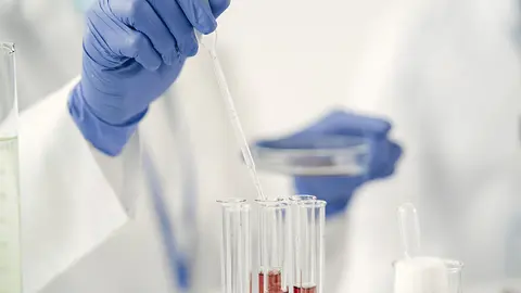 Muestras de laboratorio para identificar sospechas (Foto: envato)