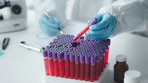 Muestras de sangre (Foto: Medicina Cantabria)