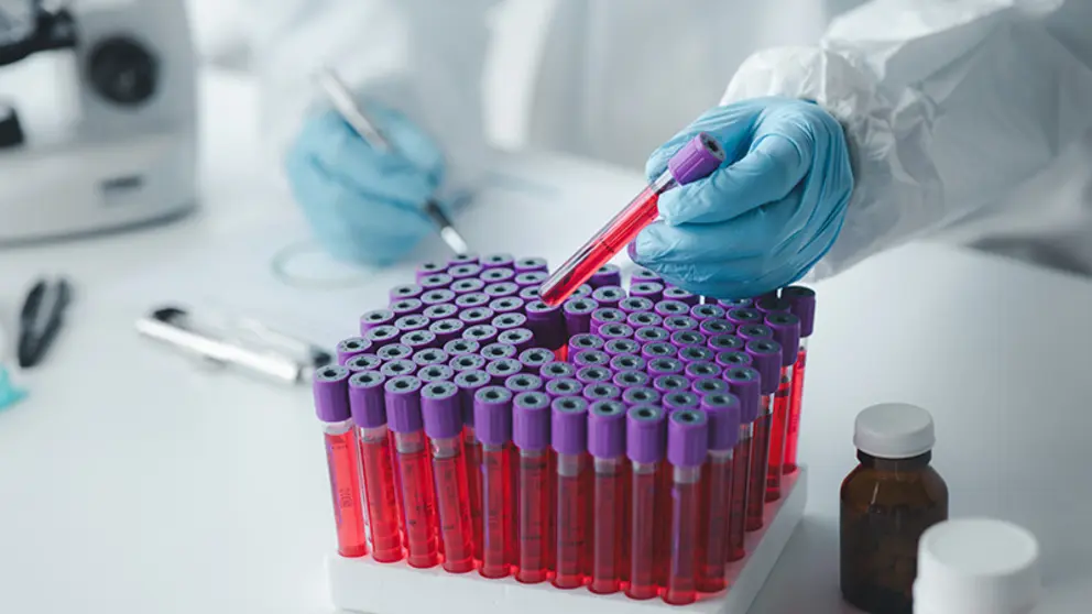 Muestras de sangre (Foto: Medicina Cantabria)